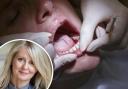 Esther McVey: 'We need to urgently repair failings of the NHS dentistry system'